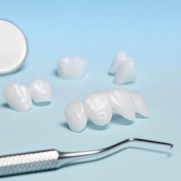 Several white dental crowns and veneers against a pale blue background