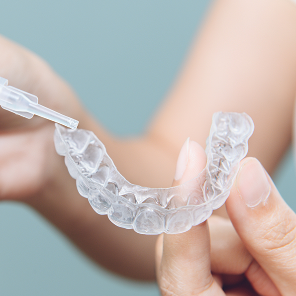 Person placing whitening gel in a teeth whitening tray