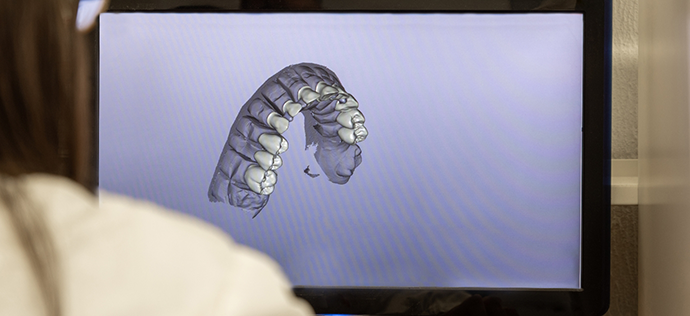 Digital model of a row of teeth on a screen