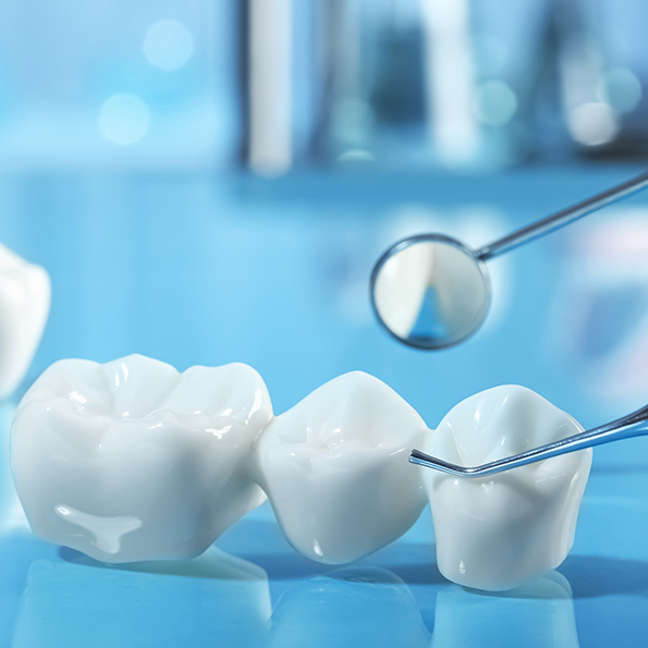 White dental bridge against a pale blue background