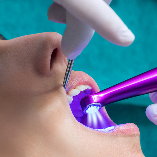 Patient having dental sealants applied to their teeth