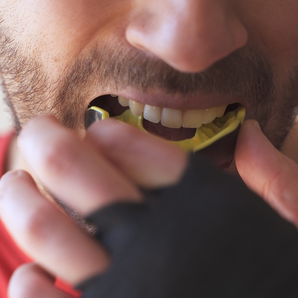 Man placing a yellow mouthguard over his teeth